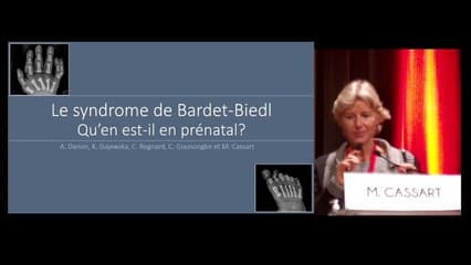 Le syndrome de Bardet-Biedl : qu’en est-il en prénatal ?