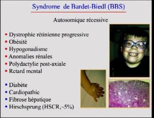 Pathologie cilaire et anomalies du développement