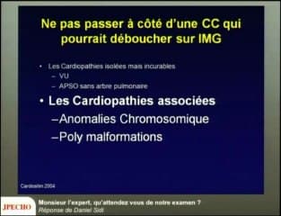 Monsieur l’Expert, qu’attendez vous de notre examen du coeur ?