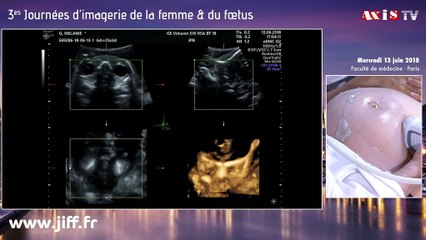 Oreilles, yeux et oropharynx Live