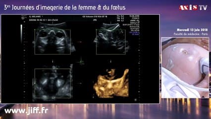 Oreilles, yeux et oropharynx Live