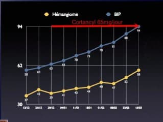 Hémangiome de la face