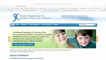 Les standards en échographie de dépistage cérébral