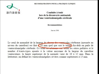 Ventriculomégalie