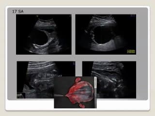 1er trimestre Mégavessies