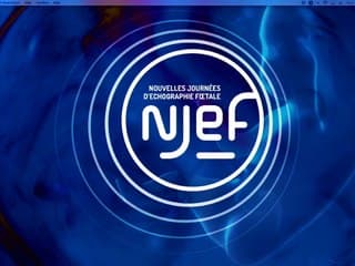 Classification des myomes et des malformations congénitales