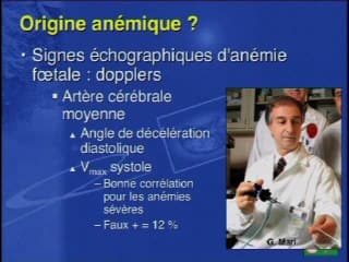 Anasarque et anémie foetale