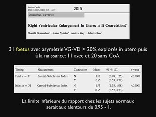 Coarctation de l’aorte : un signe plus spécifique ?