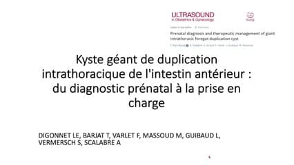 Kyste géant de duplication intrathoracique de l'intestin antérieur : du diagnostic prénatal à la prise en charge thérapeutique