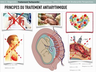 COEUR TRAITEMENT IN UTERO DES TROUBLES DU RYTHME : ENFIN DU NEUF ?