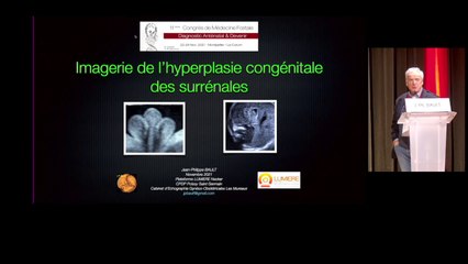 Imagerie de l’hyperplasie congénitale des surrénales
