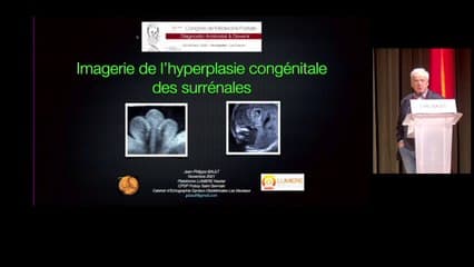 Imagerie de l’hyperplasie congénitale des surrénales