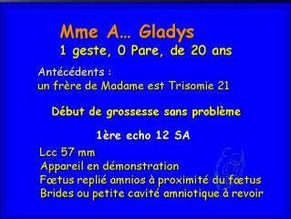 Encéphalocèle, méningocèle, brides