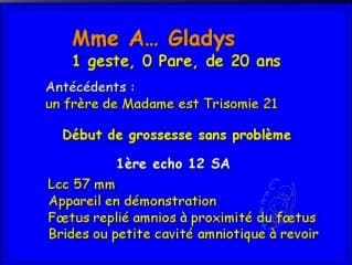 Encéphalocèle, méningocèle, brides