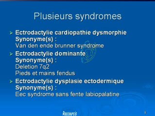 Ectrodactylie