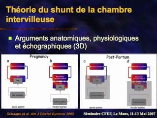 Protocole d’étude des placenta accreta : perfusion de produit de contraste échographique