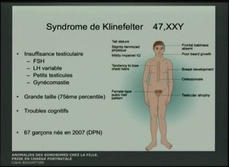 Anomalies des gonosomes Prise en charge post- natale