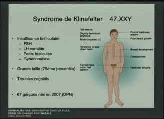 Anomalies des gonosomes Prise en charge post- natale