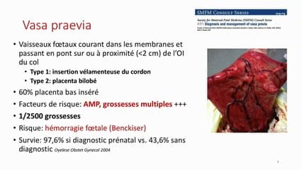 ANOMALIES DU CORDON ARTÈRE OMBILICALE UNIQUE, CORDON JUMEAUX, FAUX OMPHALOCÈLE, VAISSEAUX PRÆVIA