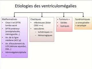 Une approche systématisée d'une ventriculomégalie "a priori" isolée.