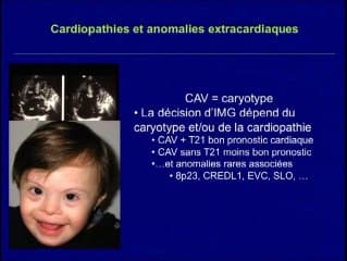 Gestion des incertitudes devant une cardiopathie congénitale fœtale