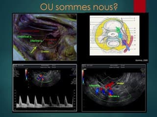 Les ovaires fertiles › La réserve ovarienne : quel est l’objectif (quels follicules compter) ? › Peut-on prévoir les risques d’hyperstimulation ou de mauvaise réponse ?