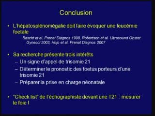 l ' hépatoslénomégalie foetale au cours de la T21