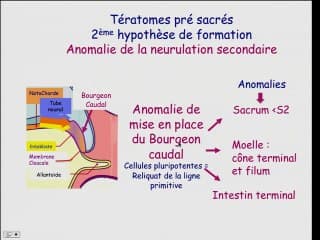 Anomalies du po_le sacré