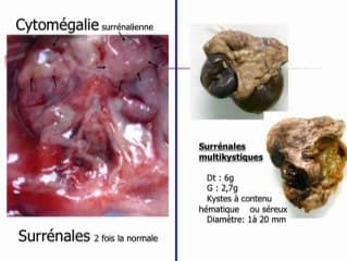 Inversion péricentrique ch 11