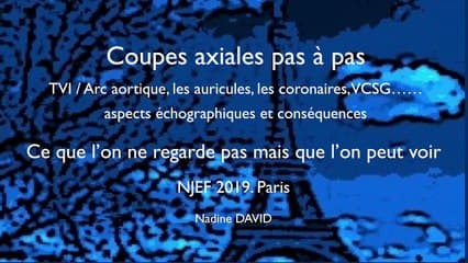 CŒUR Coupes axiales « pas à pas » TVI/Arc aortique, les auricules, les coronaires, le Tronc Veineux Inominé, VCSG : aspects et conséquences