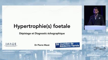 Diagnostic échographique d’hypertrophie fœtale