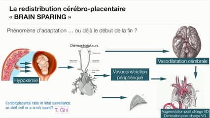 CROISSANCE ET BIEN-ÊTRE DU FŒTUS : Y a-t-il une place pour le rapport cérébro-placentaire ?