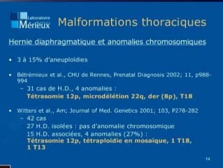Quand demander un caryotype foetal devant un signe échographique au 2eme trimestre ?Malformations thoraciques, Épanchements