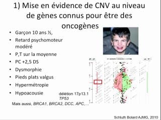 CGH Array en prénatal : état de la question, de la recherche à la clinique