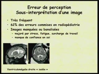Insuffisances, incertitudes, difficultés, piéges et erreurs de l'imagerie anténatale Pourquoi nous trompons-nous.