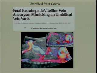 le tube digestif foetal ( en ANGLAIS )