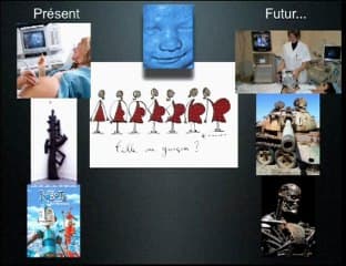 Y a t-il une place pour l'échographie volumique de dépistage au 1er trimestre ?