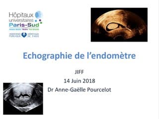 Échographie de l’endomètre : quand débute la pathologie ? › Seuil de l’endomètre épais