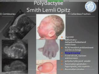 de la main aux doigts