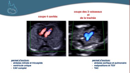Le coeur au 1er trimestre