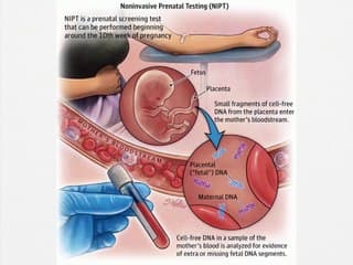 DPNI de la bonne indication au mésusage : Que retenir en 2019 ?