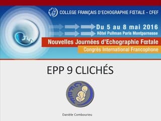 EPP des 9 clichés du CTE