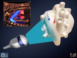 Les trompettes d'AIDI : pas toujours une marche triomphale?