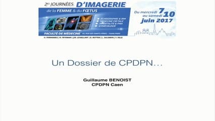 Staffs de dossiers : dossiers poumon ? Hydrothorax