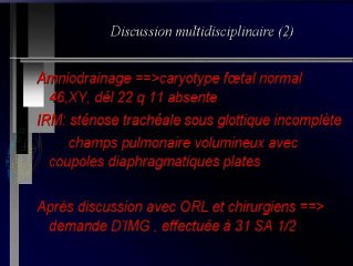 Sténose trachéale