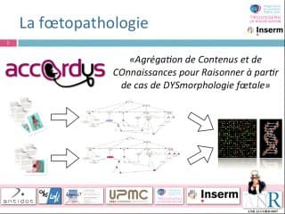 Modélisation ontologique et partage des connaissances en médecine foetale.