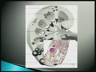 Les ciliopathies rénales - de l'échographie au phénotype.