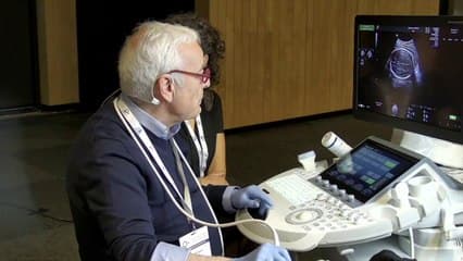 Live examen standart du cerveau foetal