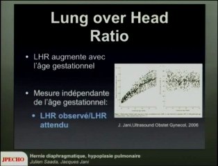 Hernie diaphragmatique, hypoplasie pulmonaire