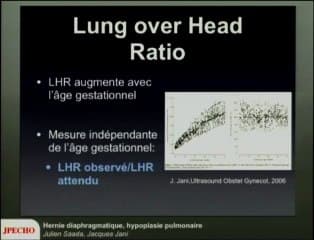Hernie diaphragmatique, hypoplasie pulmonaire